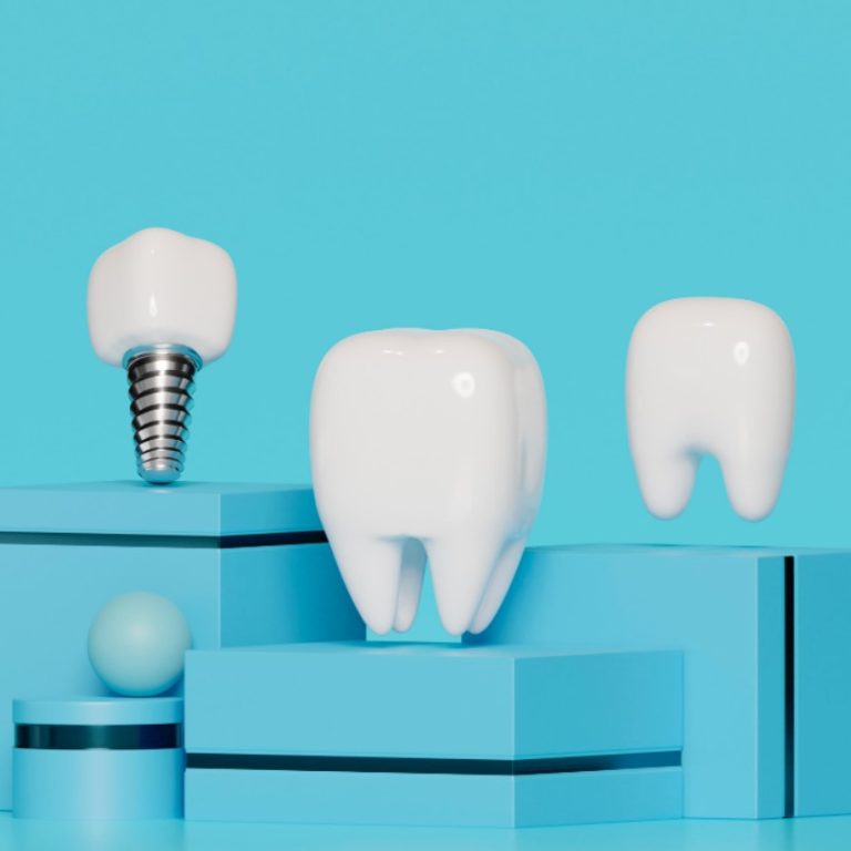 Dental Implants in Turkey
