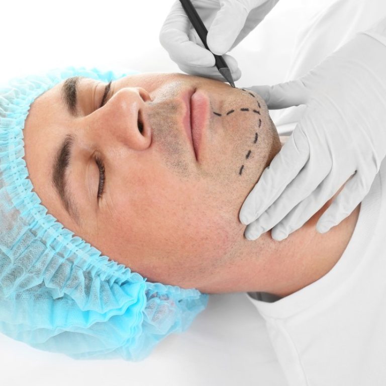 Maxillofacial Surgery (Chin Surgery)