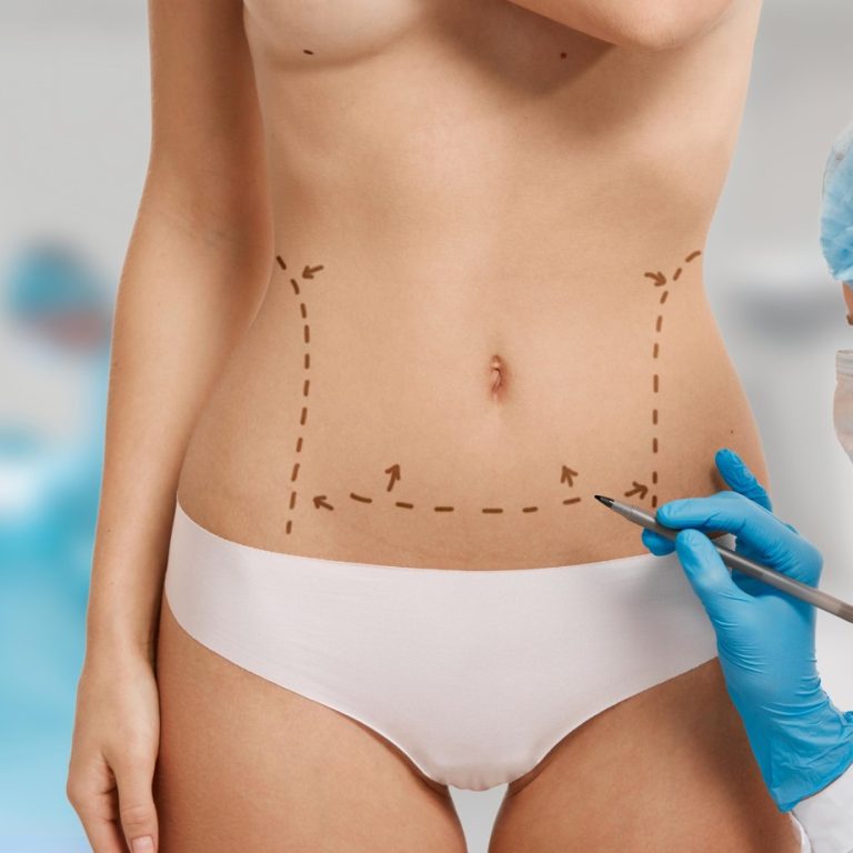 Tummy Tuck in Turkey